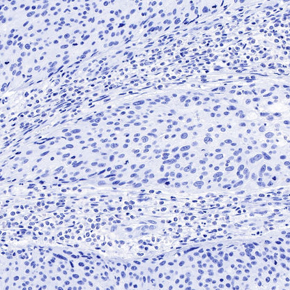 alpha-actinin-2 Recombinant Rabbit mAb (SDT-032-79)