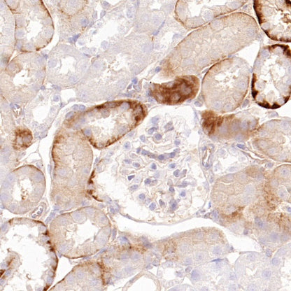Phospho-YAP (Ser127) Recombinant Rabbit mAb (S-4250)