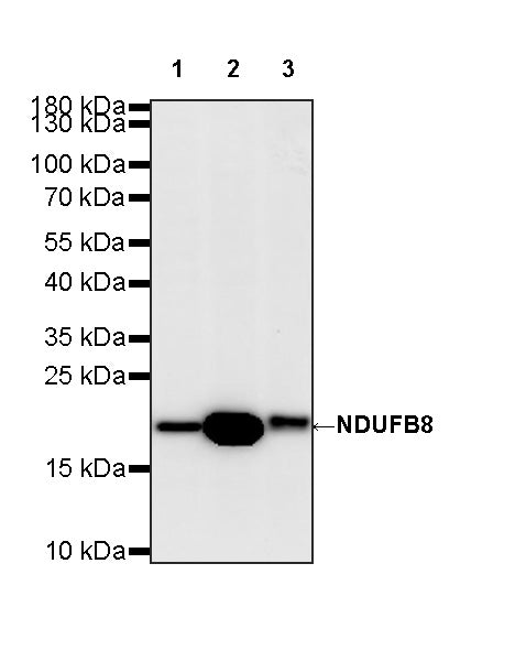 NDUFB8 Recombinant Rabbit mAb (S-4770-29)