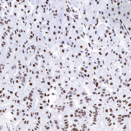FUBP1 Recombinant Rabbit mAb (S-739-21)