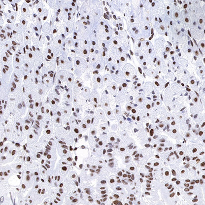 FUBP1 Recombinant Rabbit mAb (S-739-21)