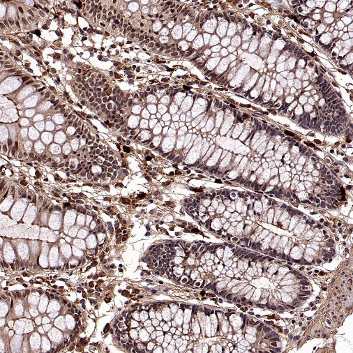 DNA Ligase IV/LIG4 Recombinant Rabbit mAb (S-2237-118)