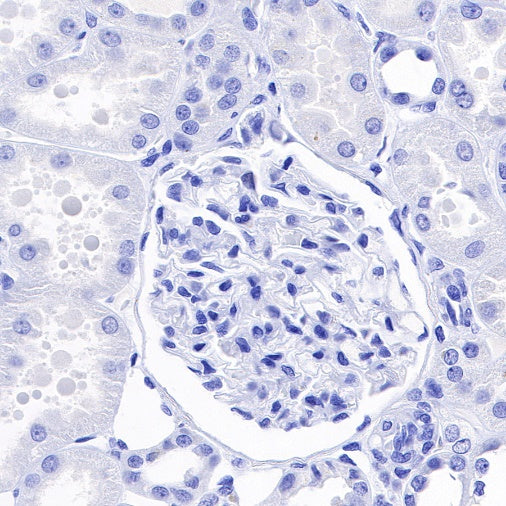 TPO Recombinant Rabbit mAb (SDT-420-57)