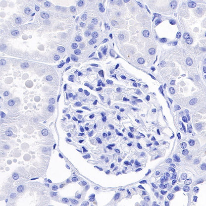 TPO Recombinant Rabbit mAb (SDT-420-57)
