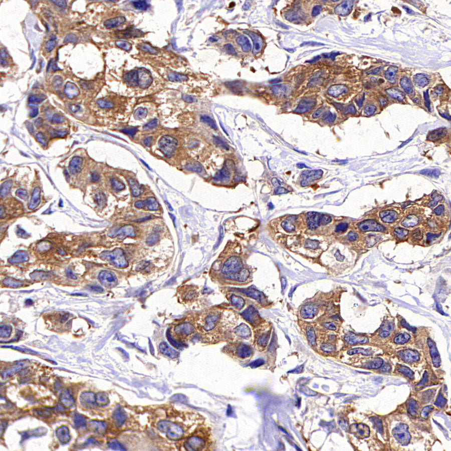 GAB1 Recombinant Rabbit mAb (S-3907-33)