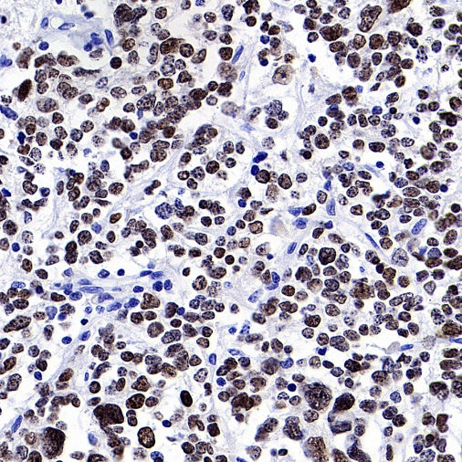 PHOX2B Recombinant Rabbit mAb (SDT-1142-21)