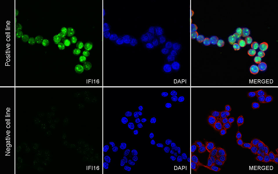 IFI16 Recombinant Rabbit mAb (S-4089-44)