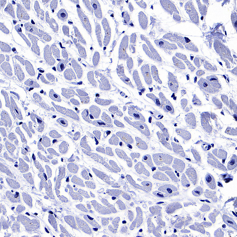 Factor XII (FXII) Recombinant Rabbit mAb (S-4487-31)