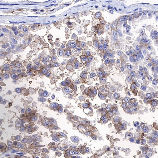 5T4 Recombinant Rabbit mAb (S-R361)