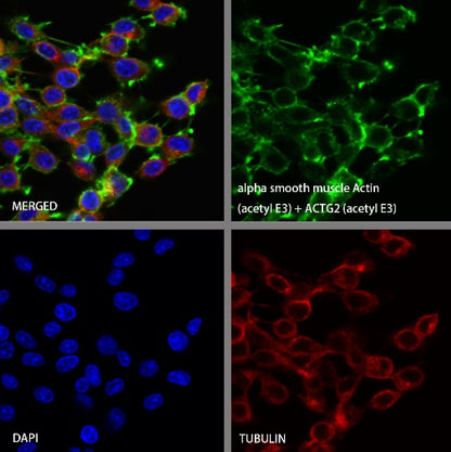 alpha smooth muscle Actin (acetyl E3) + ACTG2 (acetyl E3) Recombiant Rabbit mAb (S-3355)
