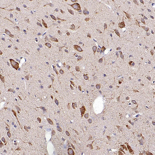 OPA1 Recombinant Rabbit mAb (S-2189-65)