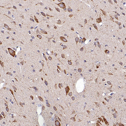 OPA1 Recombinant Rabbit mAb (S-2189-65)