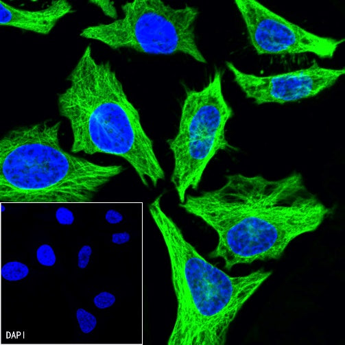 Beta IV Tubulin Rabbit polyclonal antibody