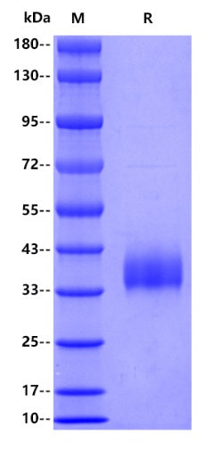 SARS-CoV-2 (JN.1/Omicron) RBD (V483del), His tag