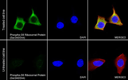 Phospho-S6 Ribosomal Protein (Ser240/244) Recombinant Rabbit mAb (S-R248)