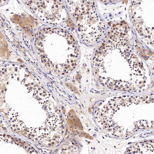 VPS35 Recombinant Rabbit mAb (S-997-2)