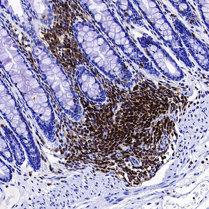 PTPN6 Rabbit Polyclonal Antibody