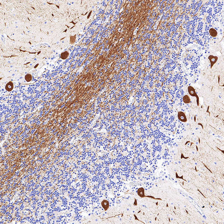 ITPR1 Recombinant Rabbit mAb (S-4530-5)