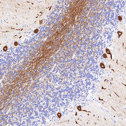 ITPR1 Recombinant Rabbit mAb (S-4530-5)