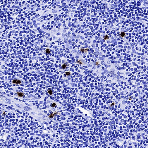 Lipocalin-2/NGAL Recombinant Rabbit mAb (S-2279-72)