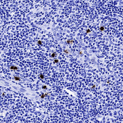 Lipocalin-2/NGAL Recombinant Rabbit mAb (S-2279-72)