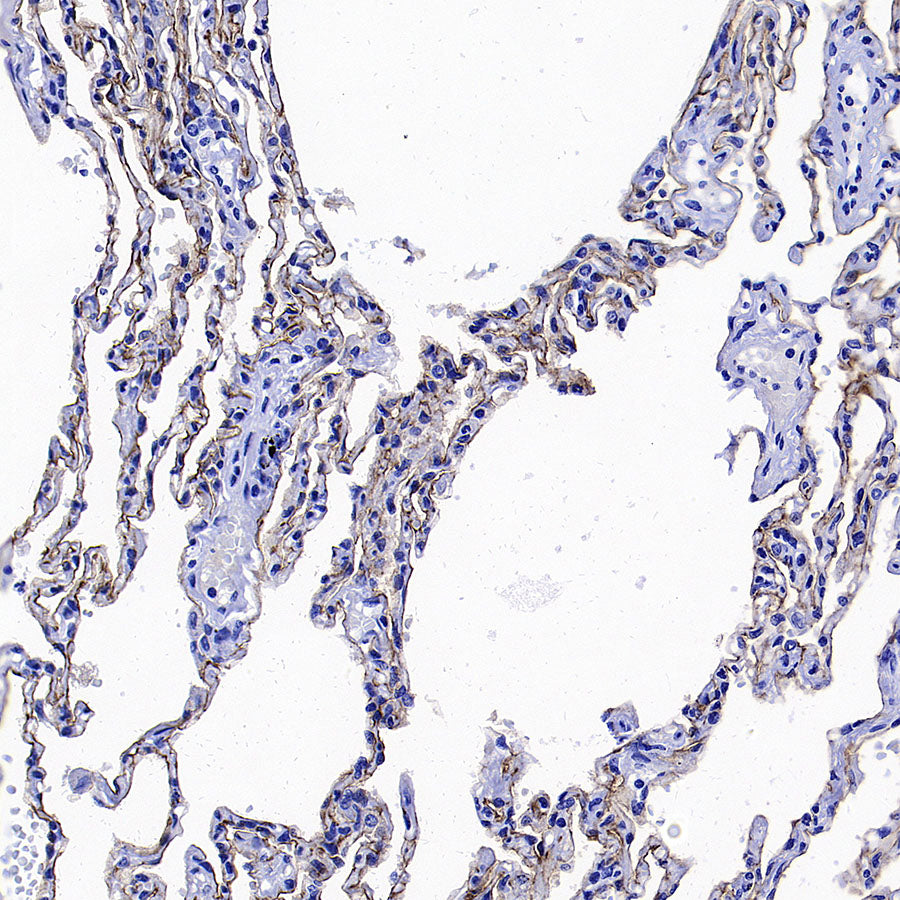 GPRC5A Recombinant Rabbit mAb (S-4383-15)