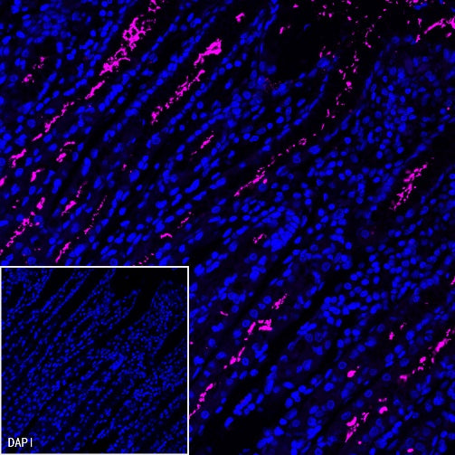 Helicobacter pylori Recombinant Rabbit mAb (Cy5 Conjugate) (S-R273)