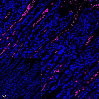 Helicobacter pylori Recombinant Rabbit mAb (Cy5 Conjugate) (S-R273)