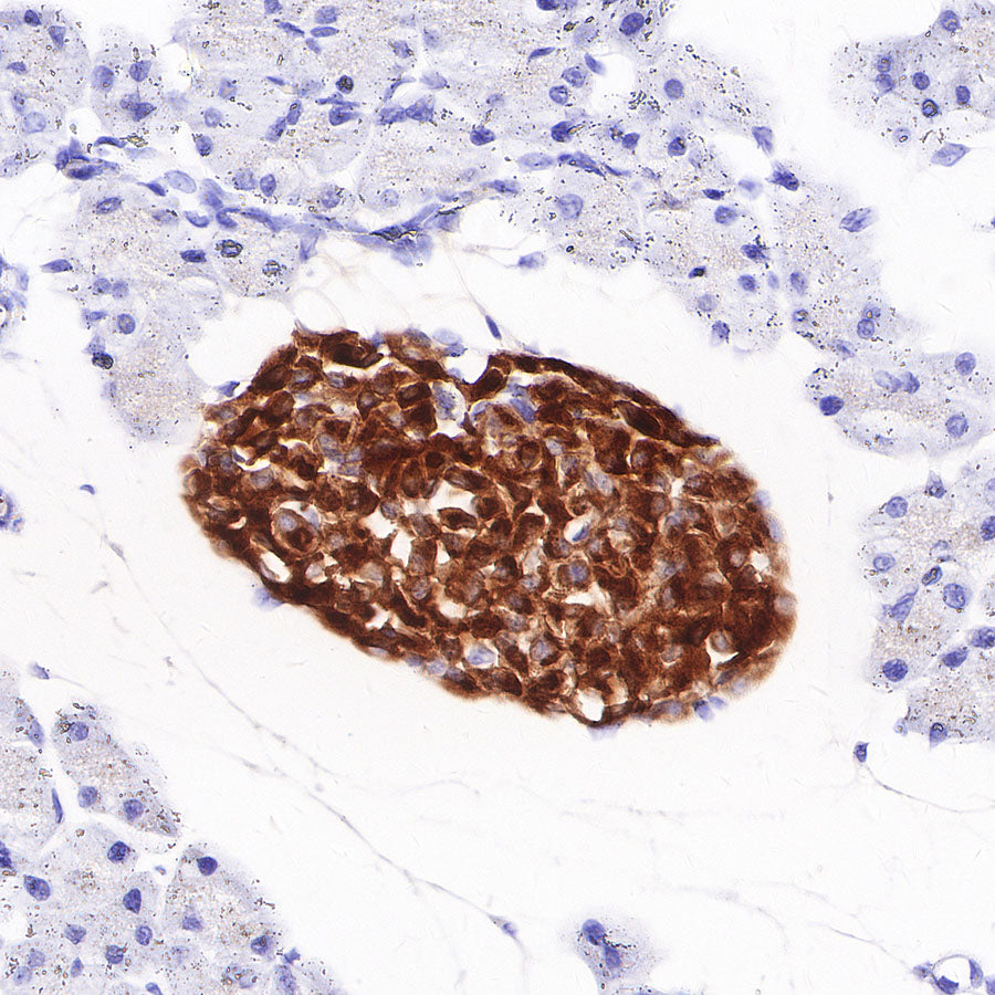 S-RMab® Chromogranin A Recombinant Rabbit mAb (SDT-074-57)