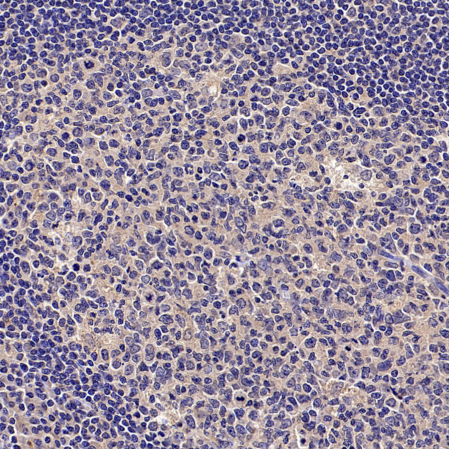 HLA Class I-A Recombinant Mouse mAb (S-3834)
