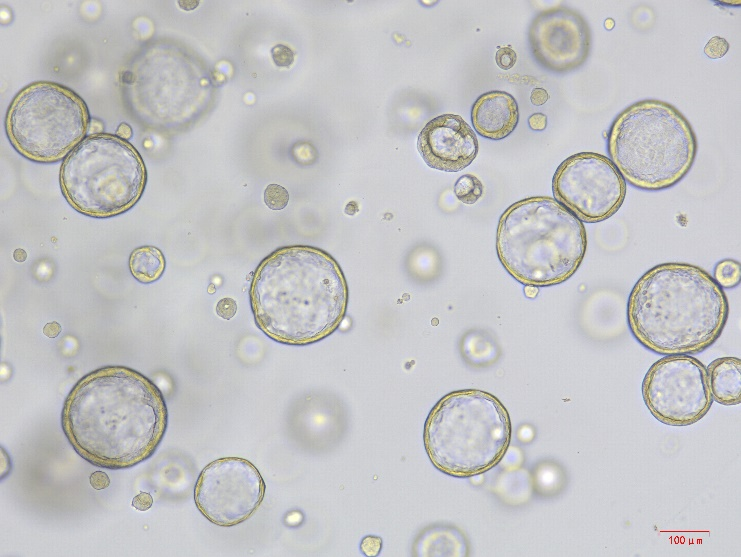 Lung organoids Cytokine Set,Mouse/小鼠正常肺类器官细胞因子套装