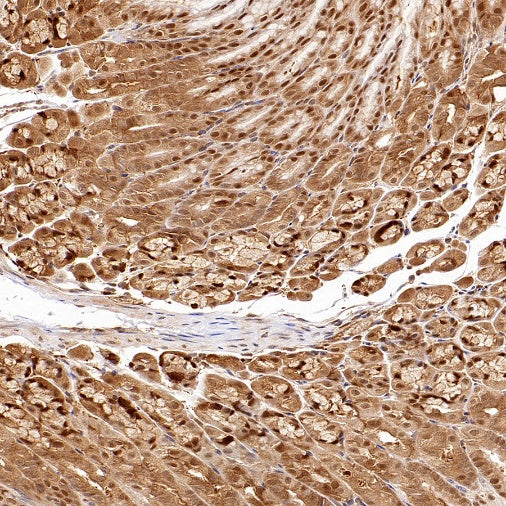 ACLY/ATP citrate lyase Recombinant Rabbit mAb (S-2025-32)