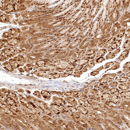 ACLY/ATP citrate lyase Recombinant Rabbit mAb (S-2025-32)