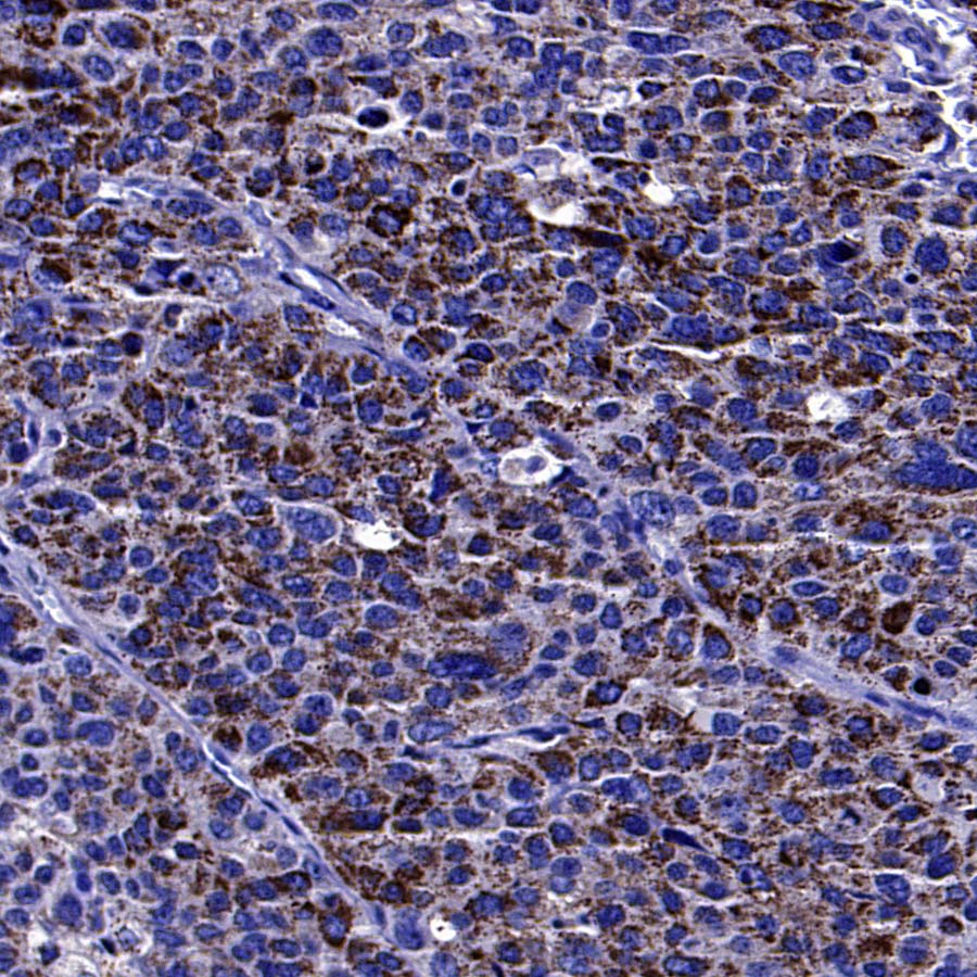 Rab27A Recombinant Rabbit mAb (S-4453-62)