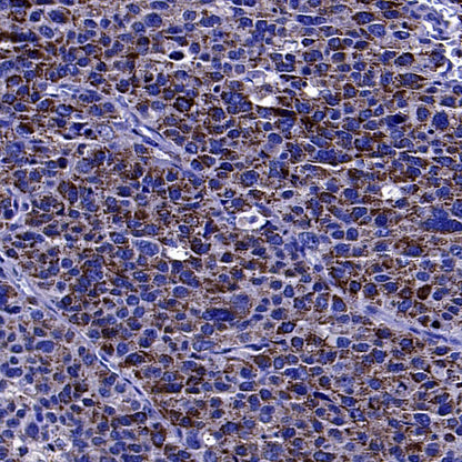 Rab27A Recombinant Rabbit mAb (S-4453-62)