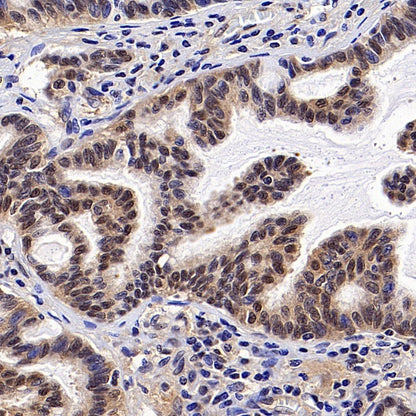 SMAD2 Recombinant Rabbit mAb (S-1420-20)
