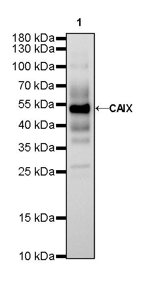 CAIX Recombinant Rabbit mAb (SDT-356-21)