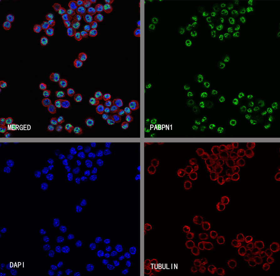 PABPN1 Rabbit Polyclonal Antibody