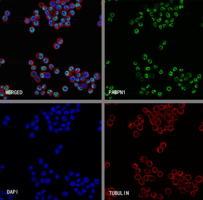 PABPN1 Rabbit Polyclonal Antibody