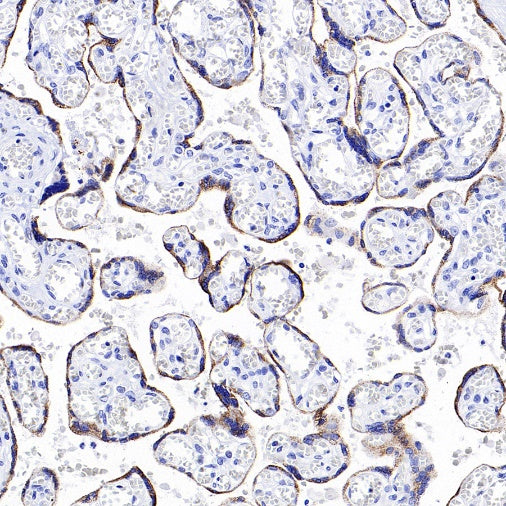 CYP11A1 Rabbit Polyclonal Antibody