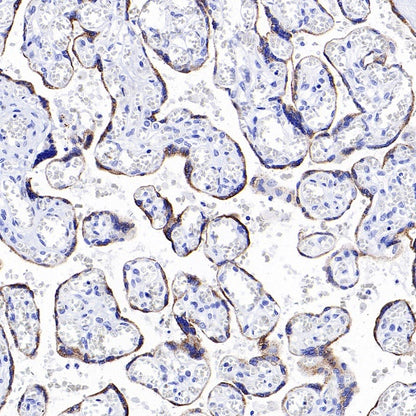 CYP11A1 Rabbit Polyclonal Antibody