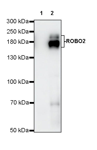 ROBO2 Recombinant Rabbit mAb (S-4563-43)