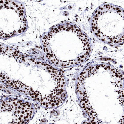 Histone H2A.X Recombinant Rabbit mAb (S-1772-179)