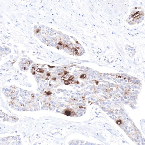 S-RMab® GCDFP-15 Recombinant Rabbit mAb (SDT-R030)