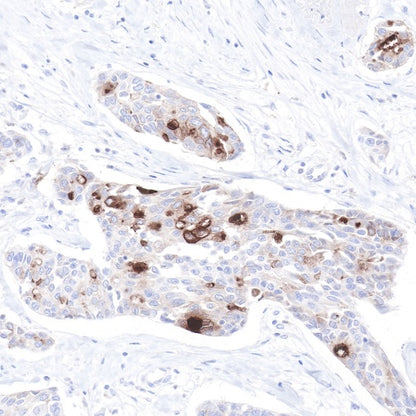 S-RMab® GCDFP-15 Recombinant Rabbit mAb (SDT-R030)