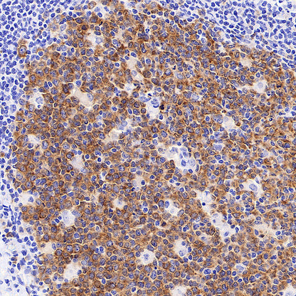 IMP3 Recombinant Rabbit mAb (S-6196)