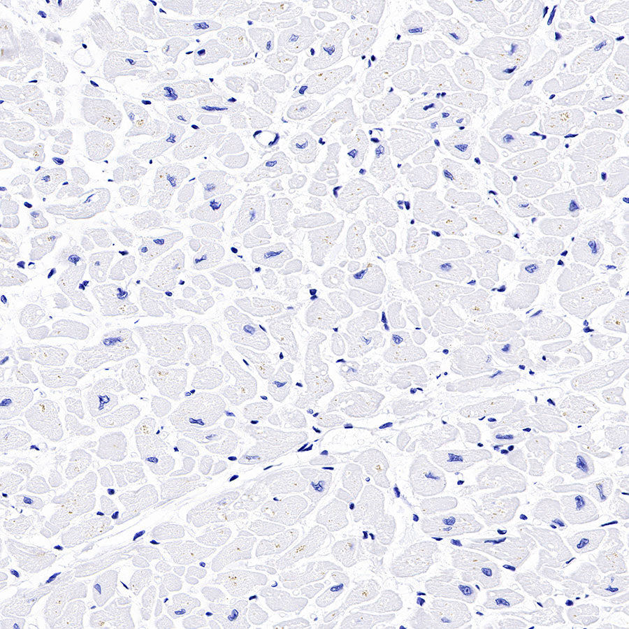 Thyroglobulin Recombinant Rabbit mAb (SDT-209-297)
