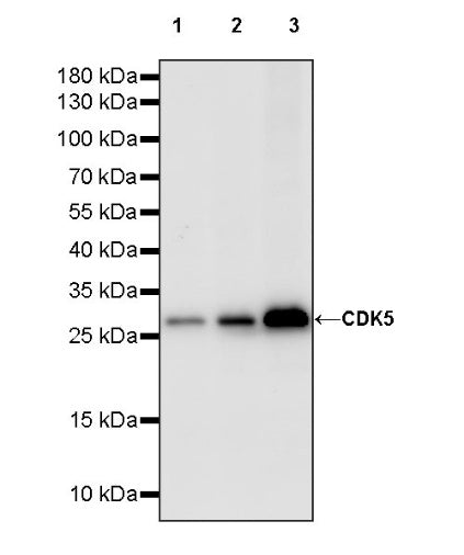 CDK5 Recombinant Rabbit mAb (S-1309-115)