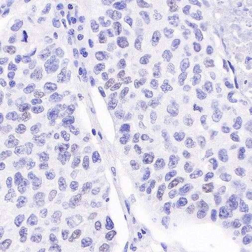 SAGE1 Recombinant Rabbit mAb (SDT-317-60)