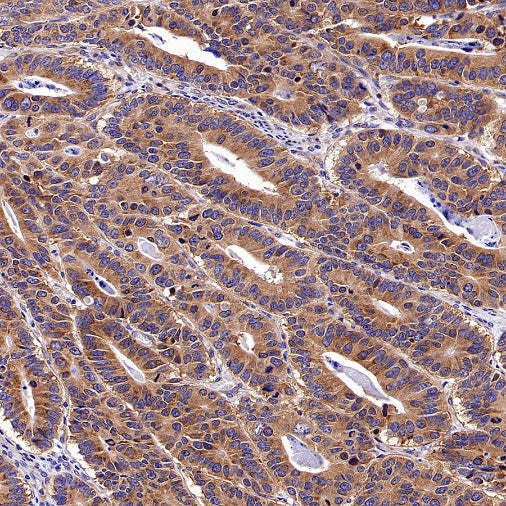 Argonaute 2 Recombinant Rabbit mAb (S-2620-13)